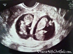 twins ultrasound