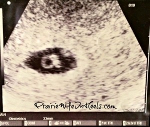 ultra sound